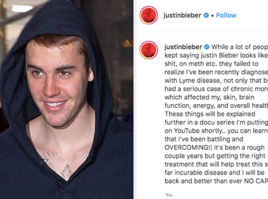 justinbieberlymedisease Toronto Times