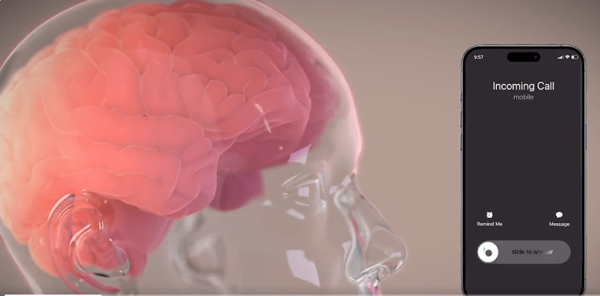 Neuralink implants First chip inside human brain