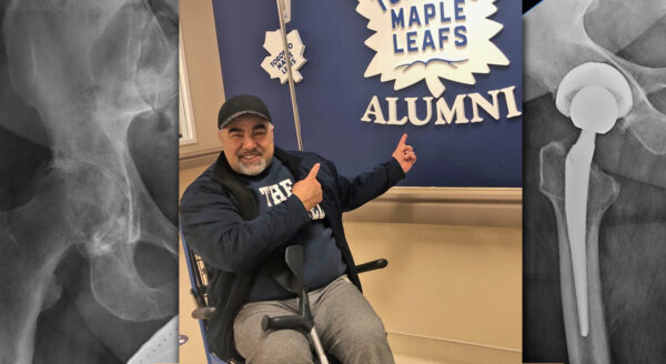 My robotic hip replacement