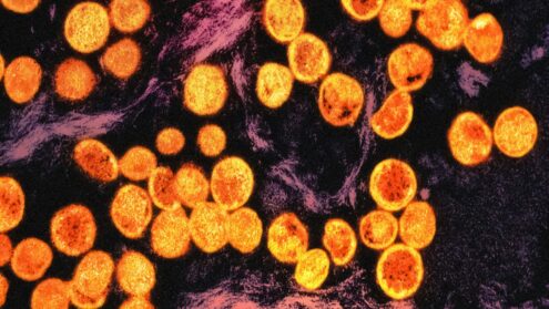 Toronto Public Health mpox vaccine